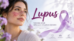 Lupus Nedir? Belirtileri, Nedenleri ve Tedavisi